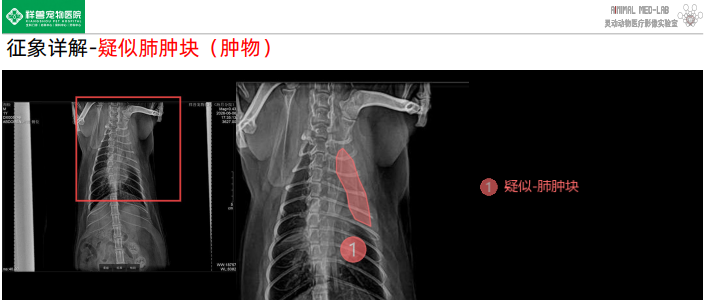 疑似肺肿块区域局部放大图